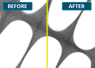 After ノイズ除去