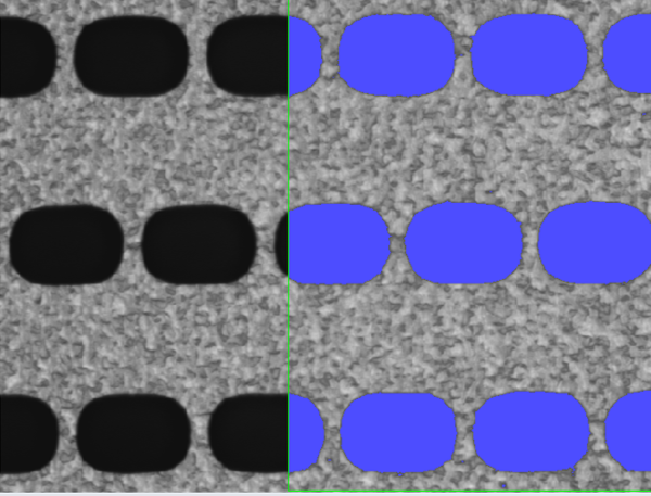 Before セグメンテーション