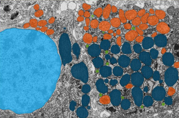 Before セグメンテーション